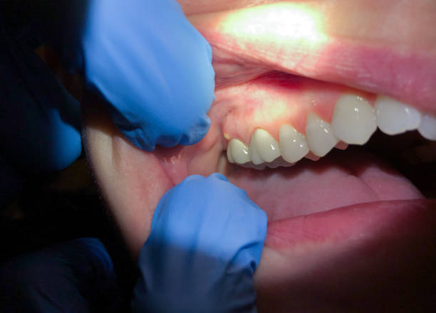 Best Emergency Broken Tooth Repair in Stony Point, MI