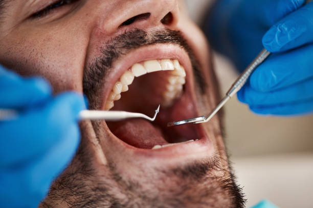 Best After-Hours Emergency Dentist in Stony Point, MI